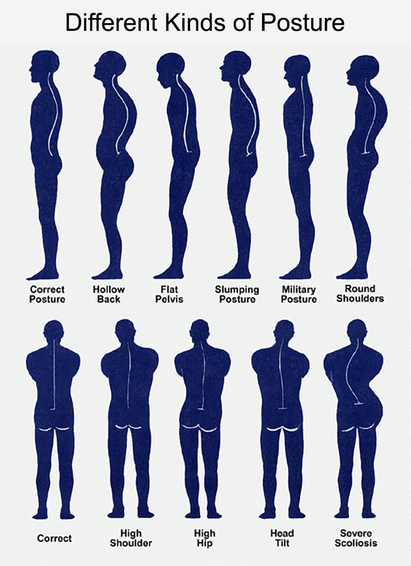Different types of posture