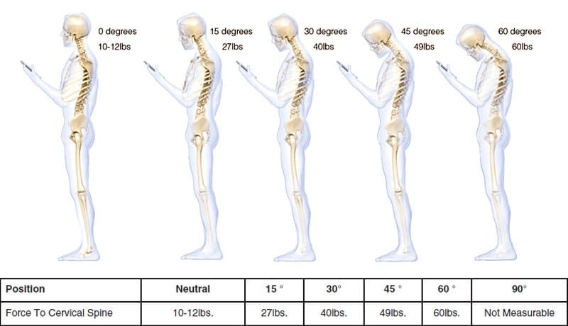 What looking down at your phone does to your spine